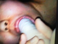 はりはり [695/845]